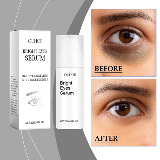 Eye Essence Moisturizes And Tightenes The Skin Around The Ey