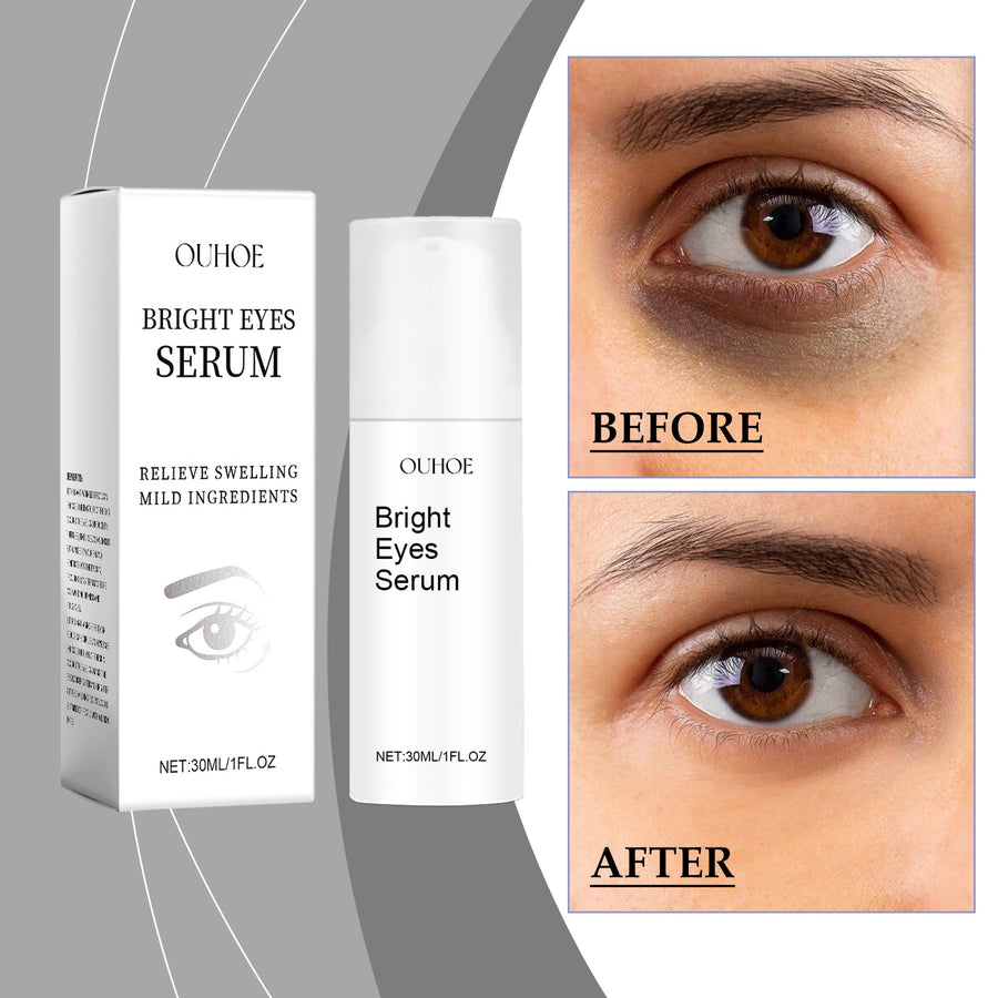 Eye Essence Moisturizes And Tightenes The Skin Around The Ey