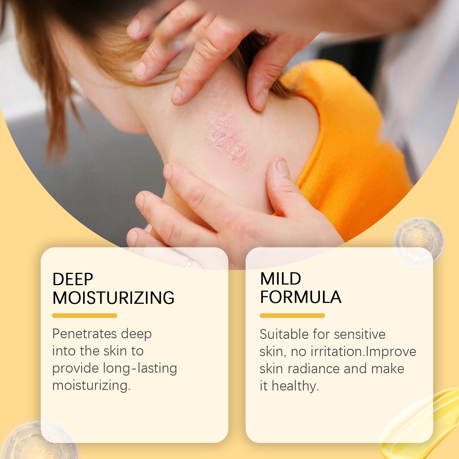 Before/after comparison of psoriasis treatment results on neck area