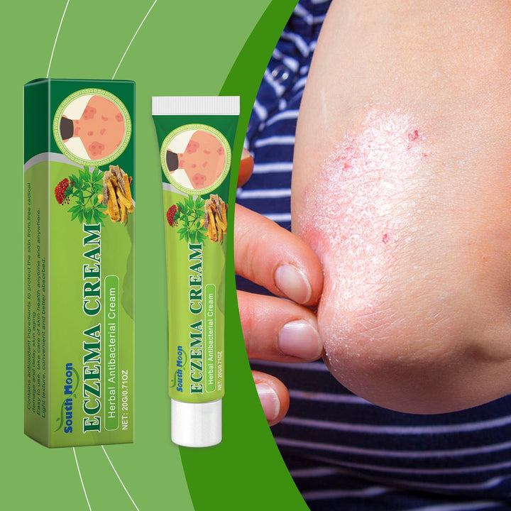 Herbal Antibacterial Cream for Itchy Dry Hands and Feet