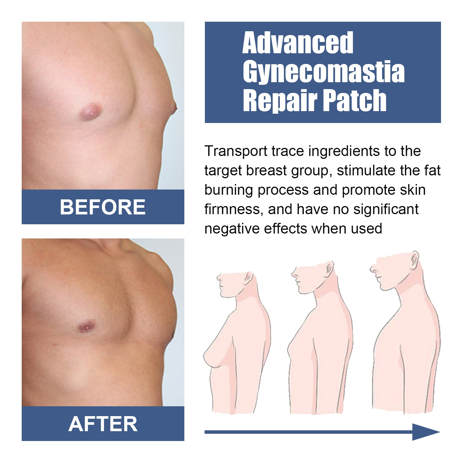 Shirtless male model with marked chest area and product benefits listed: stimulate fat burning, accurate and painless, promote collagen production, skin tightening, uniform color, suitable for multiple ages, with clinical before/after inset