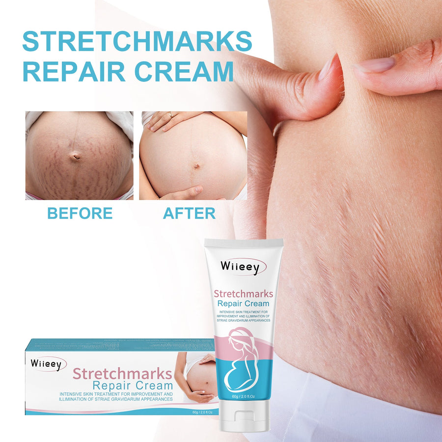 Stretch Mark Repair Cream for Pregnancy Skin Recovery
