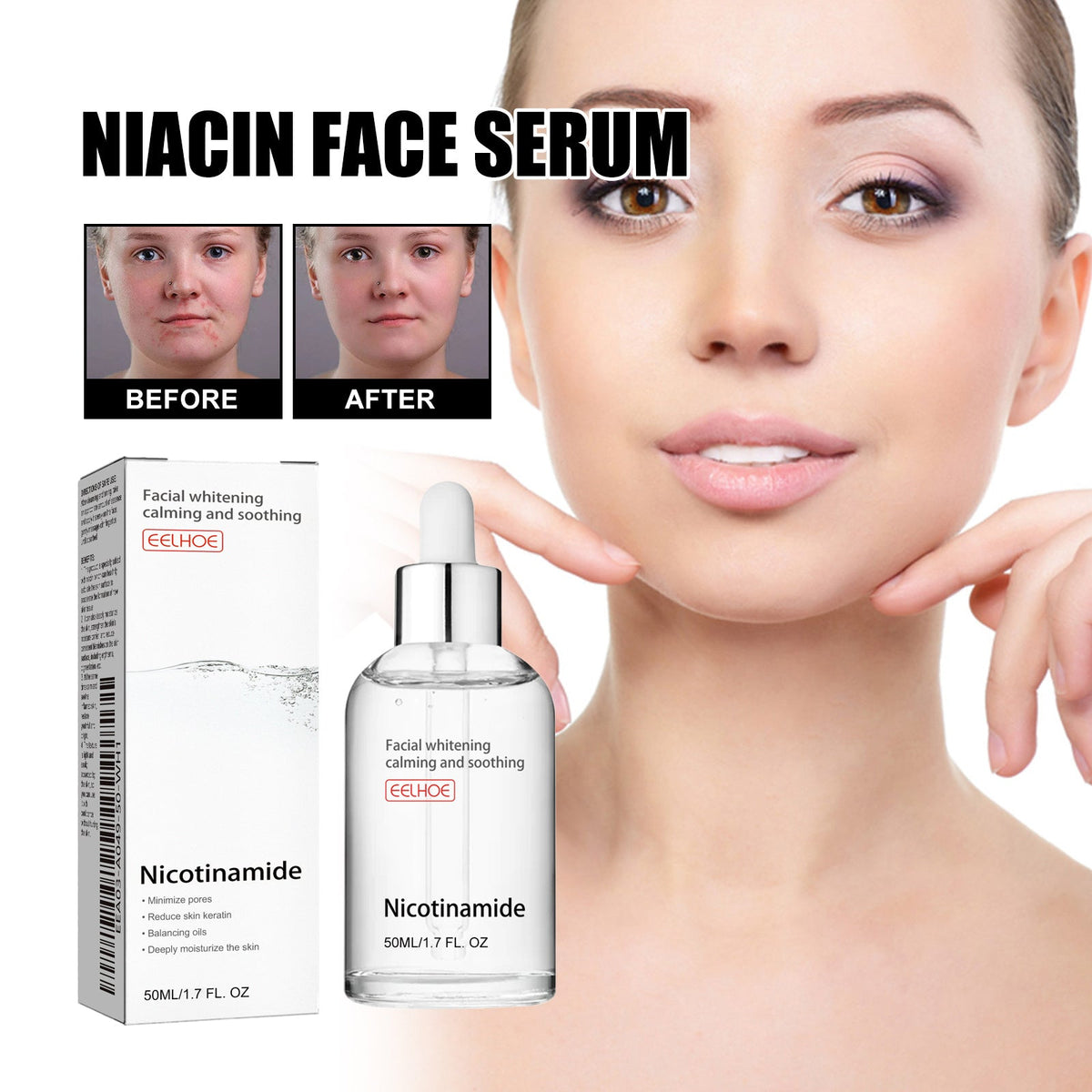 Niacinamide Face Essence for Acne Marks & Pores