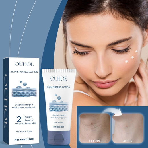 Skin Firming Lotion for Crepey, Sagging Skin