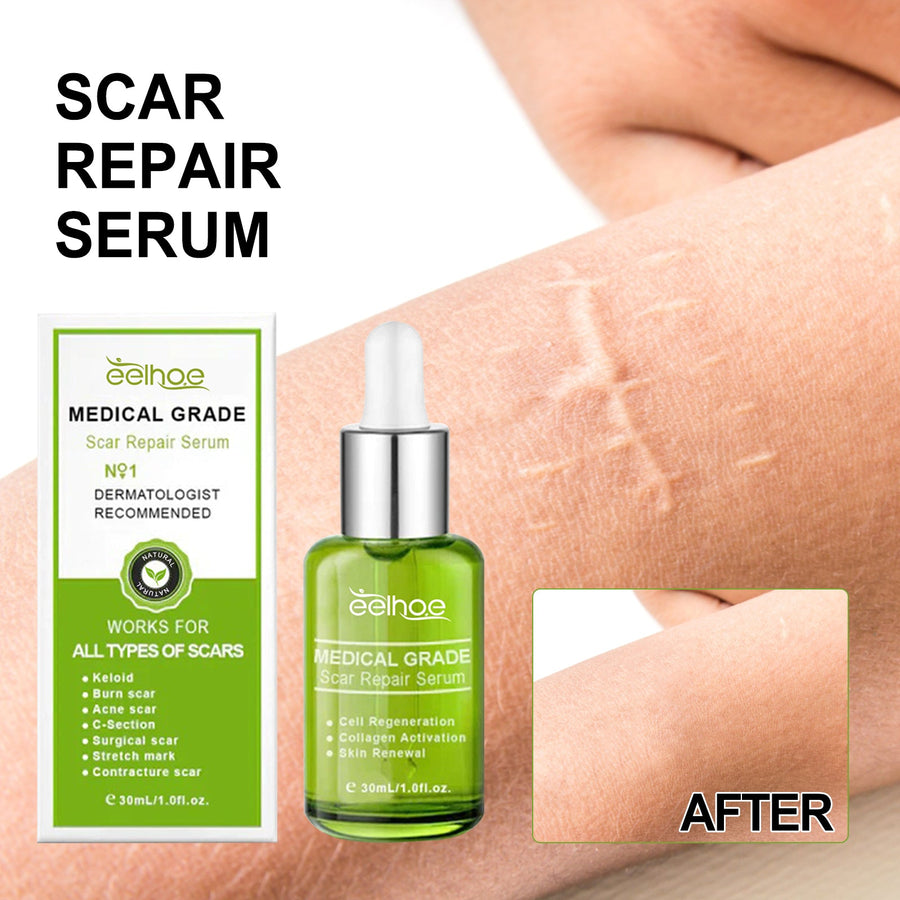 Scar Repair Serum — Flatten & Smooth All Scars in Weeks