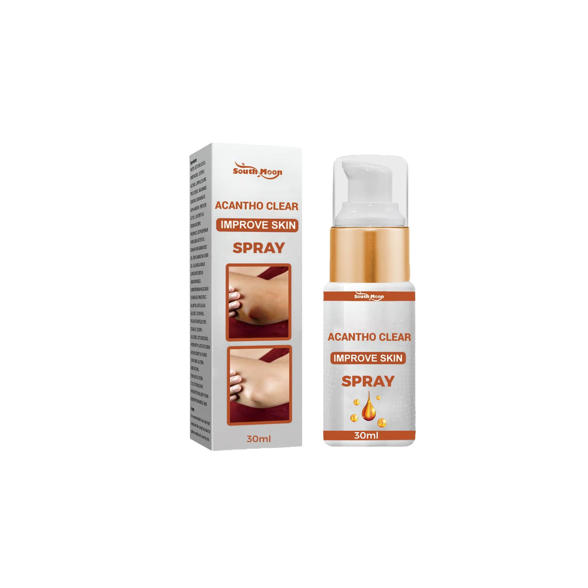 Acantho Clear Spray for Dark Elbows & Knees