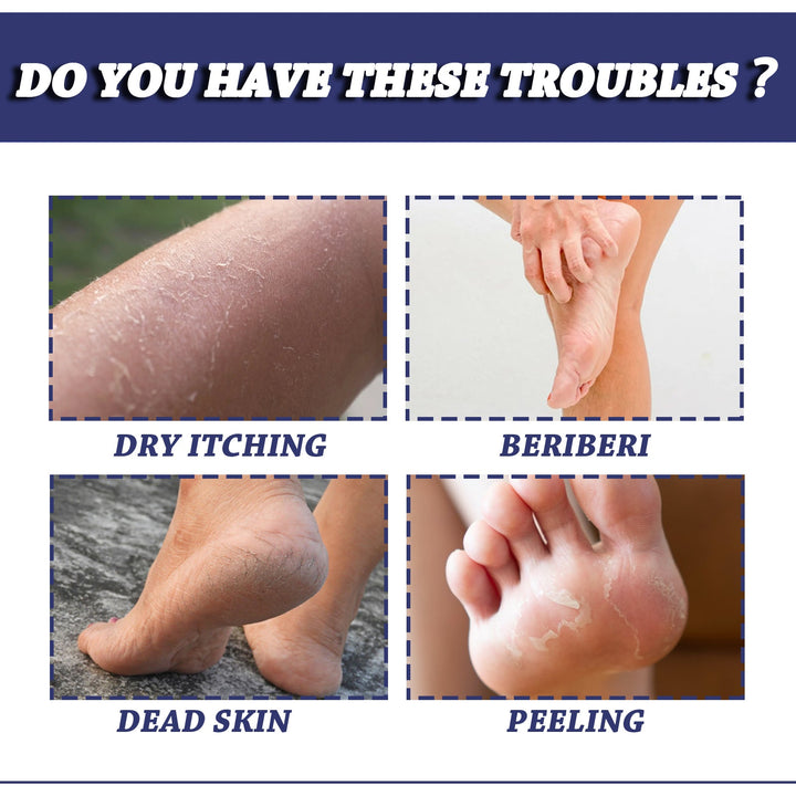 Tea Tree Oil Foot Balm — Heal Cracked Heels & Dry Skin