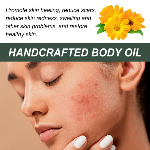Calendula Body Oil for Dry, Red, Scar-Prone Skin Care