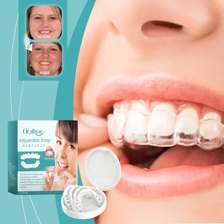 Snap-On Dentures — Adjustable Comfort & Natural‑Looking Smile