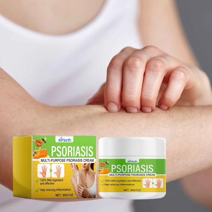 Psoriasis Cream for Itchy, Red, Irritated Skin Relief