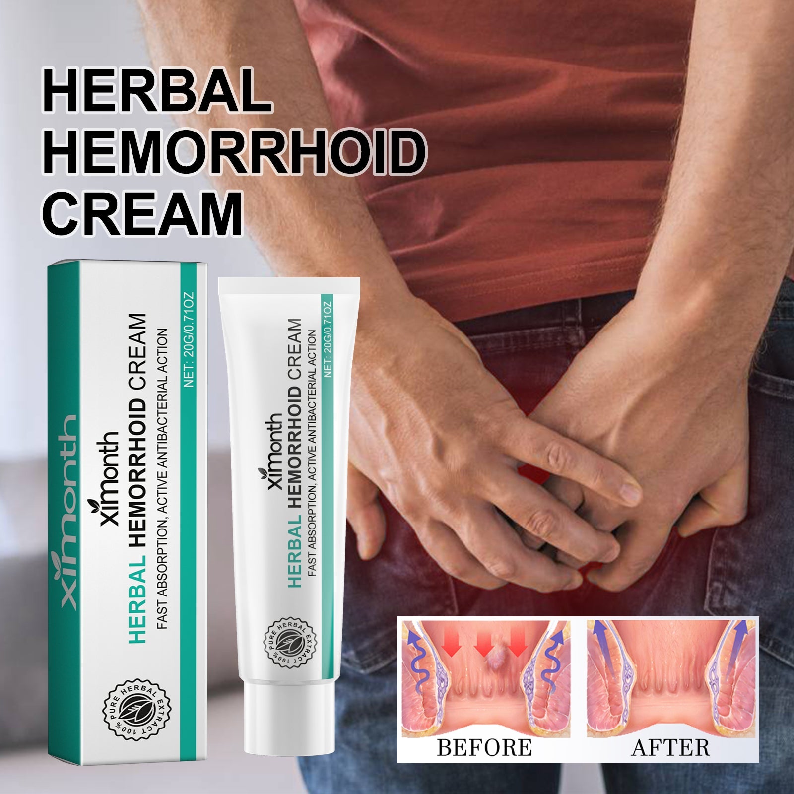 Risk factors infographic showing bad diet, pregnancy, obesity, and prolonged sitting as hemorrhoid causes