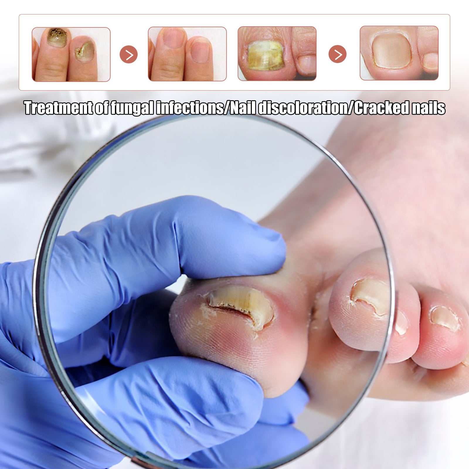 Detailed magnified view identifying three nail problems: fungal infections, nail discoloration, and cracked nails with clinical examination tools