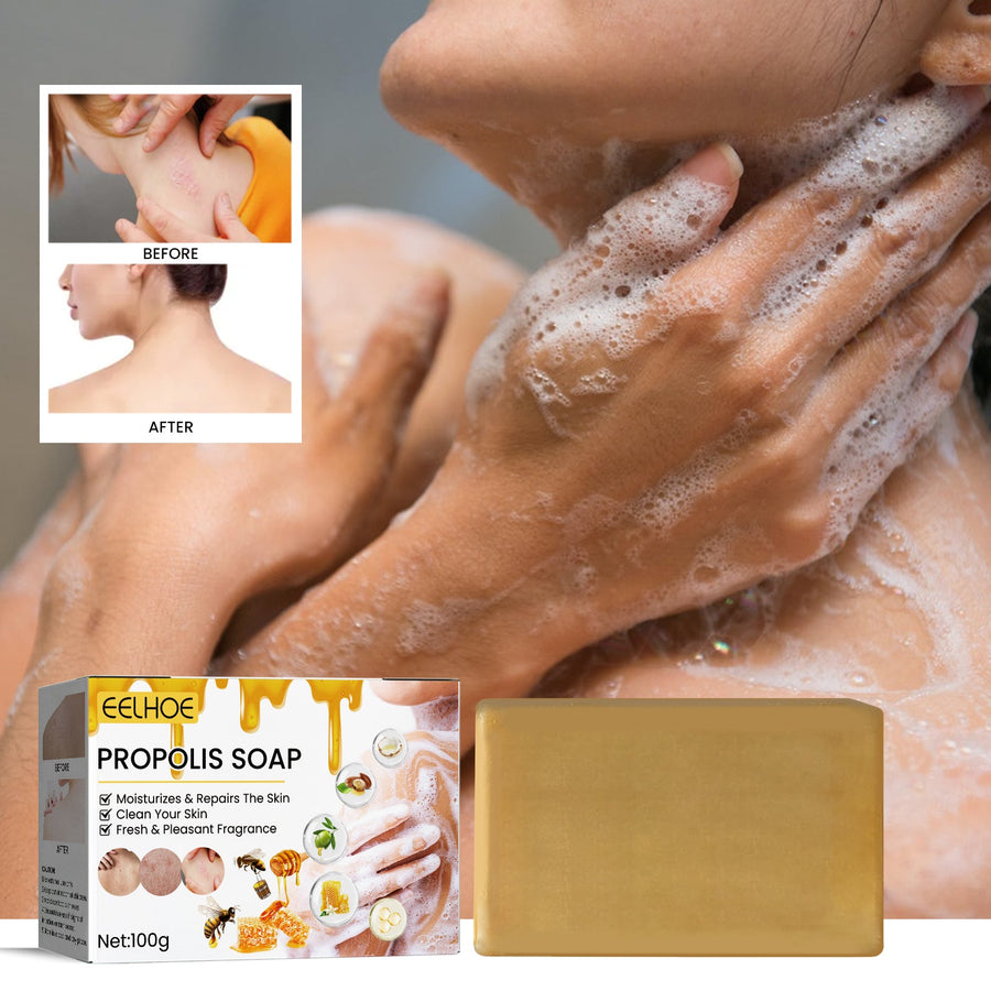 EELHOE Propolis Soap for Acne-Prone & Dry Skin