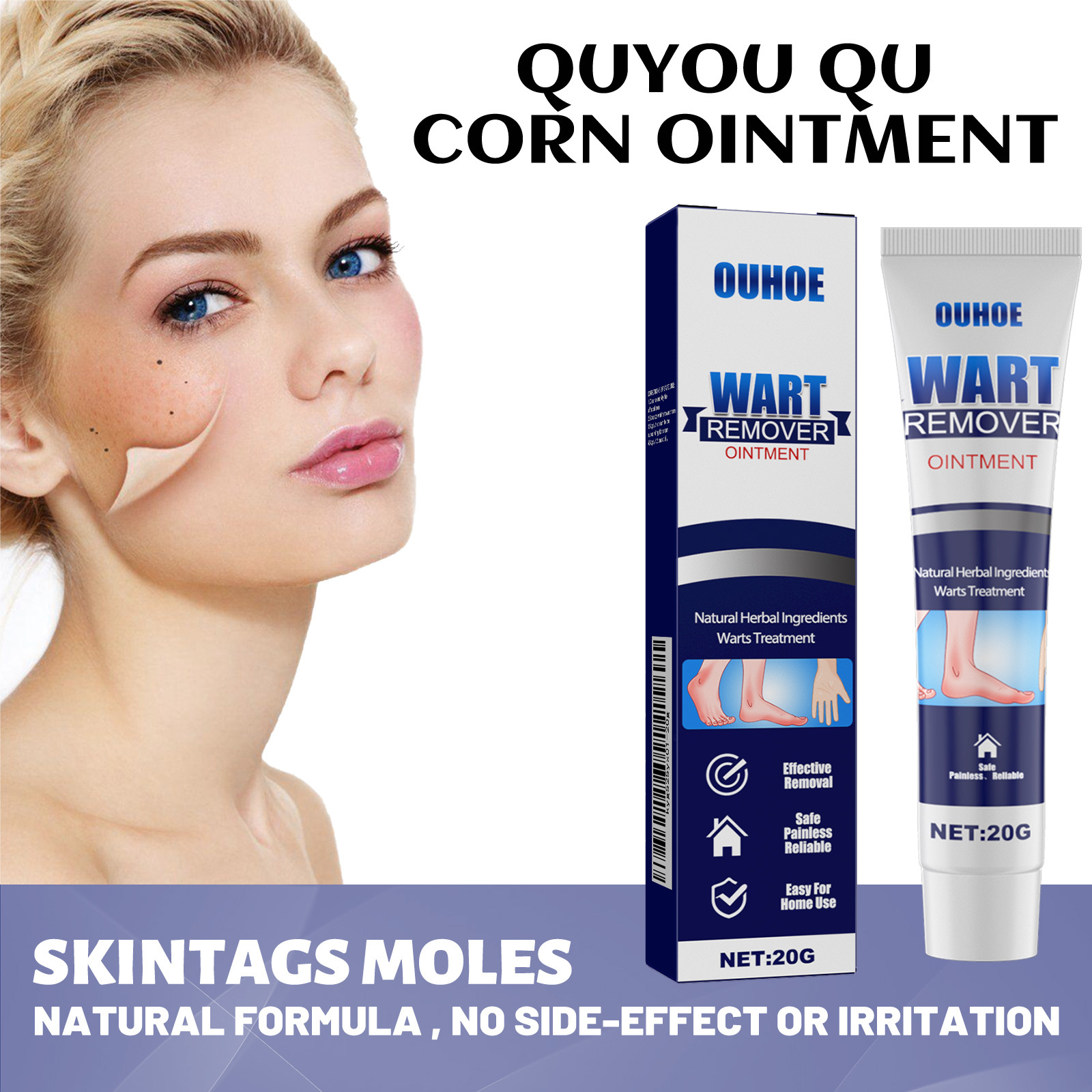 OUHOE Wart Remover Ointment product box and tube displayed side-by-side showing full branding, claims, and 20g net weight