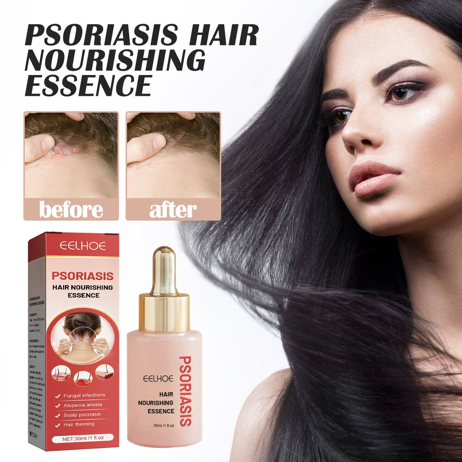 Scalp Nourishing Serum for Dandruff & Itchy Scalp