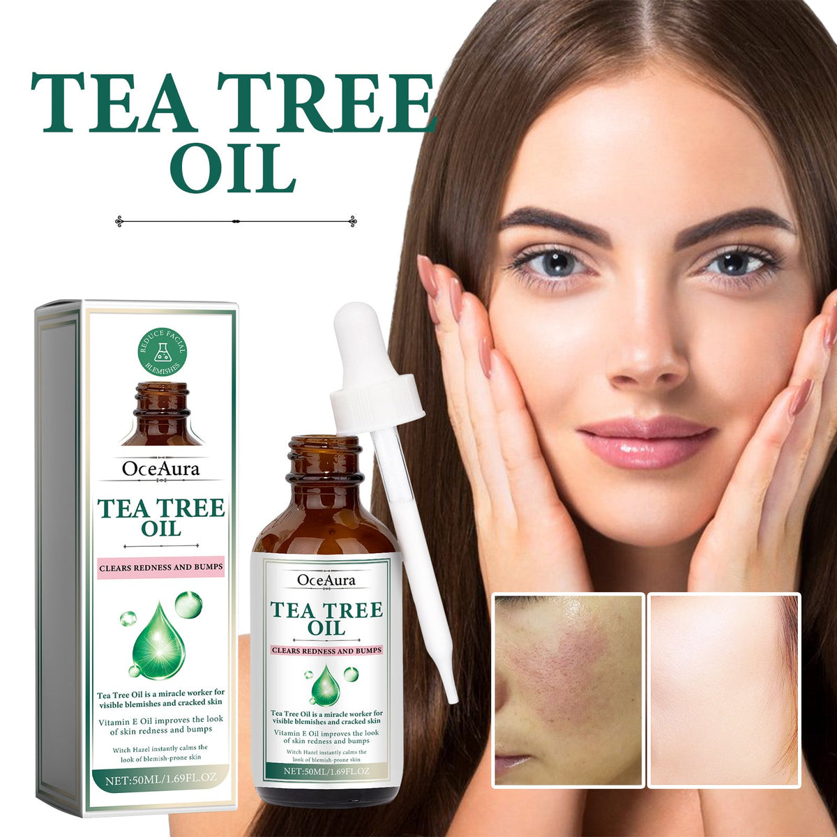 Tea Tree Oil Serum for Redness & Blemish-Prone Skin