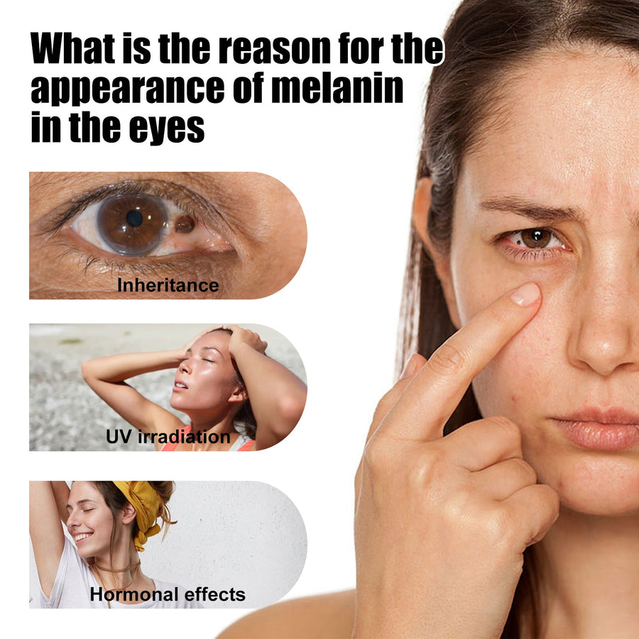 Eye Care Roller for Dark Circles and Tired-Looking Eyes