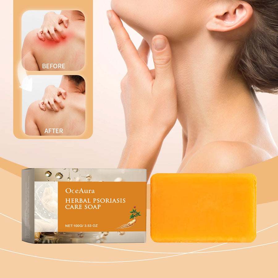 OCEAURA Herbal Psoriasis Care Soap, Soothing And Moisturizin
