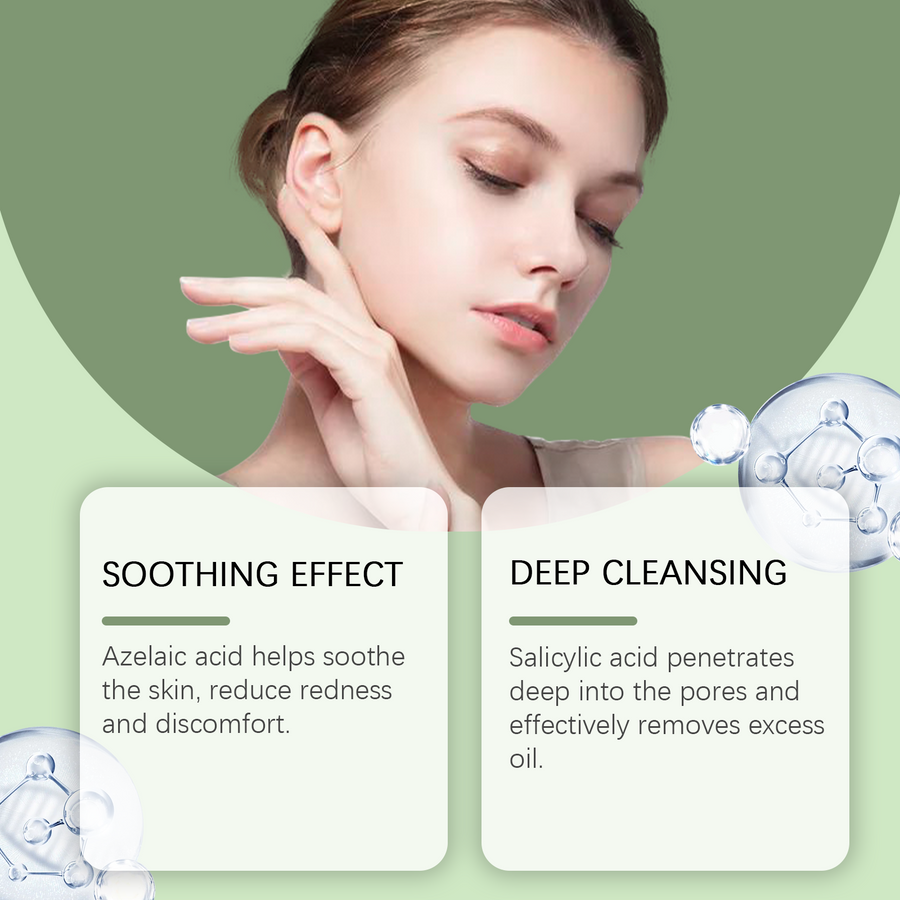Herbal Acne Cream for Calmer, Clearer-Looking Skin