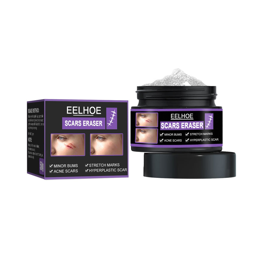 Skin Repair Cream — Visibly Fade Acne Scars & Stretch Marks