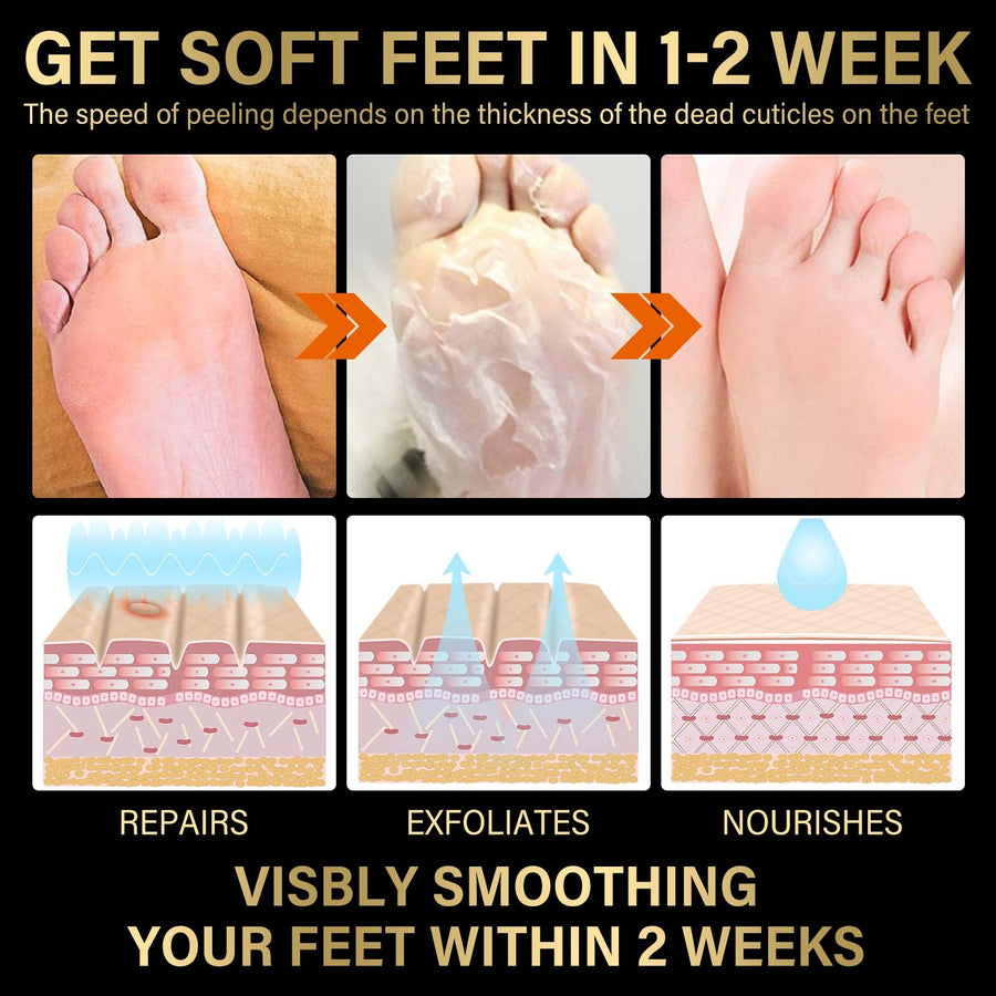 Lavender Foot Peel Mask for Soft, Crack-Free Heels