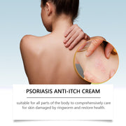 Ximonth Psoriasis Anti-Itch Cream packaging showing branded box and frosted glass jar with pale yellow cream and gold metal lid