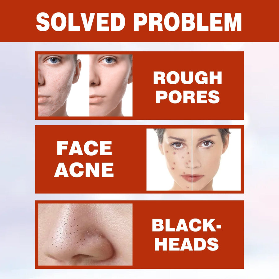 Pore Minimizer Serum - Refined-Looking Skin