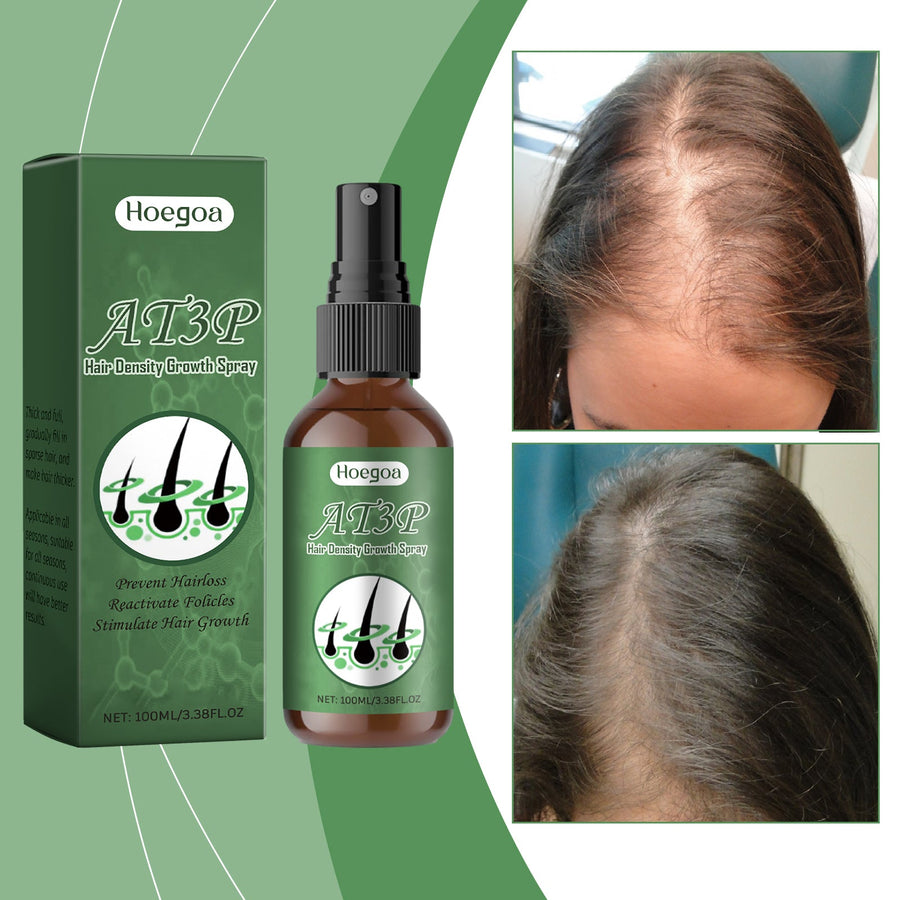 Hair Growth Spray for Fuller-Looking, Nourished Hair