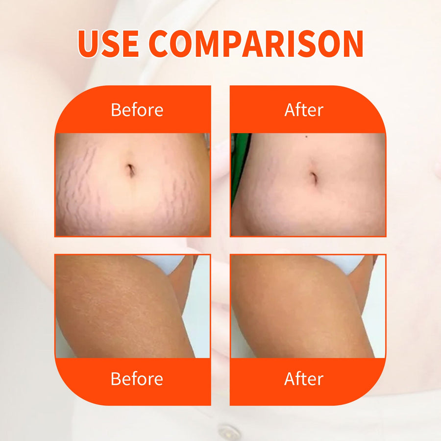 Scar Repair Body Oil for Smoother, Firmer-Looking Skin