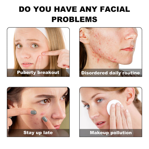 Acne Patches — Fast, Gentle Coverage For Breakout Days
