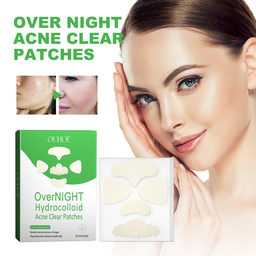 Overnight Acne Patches - Hydrocolloid Pimple Treatment