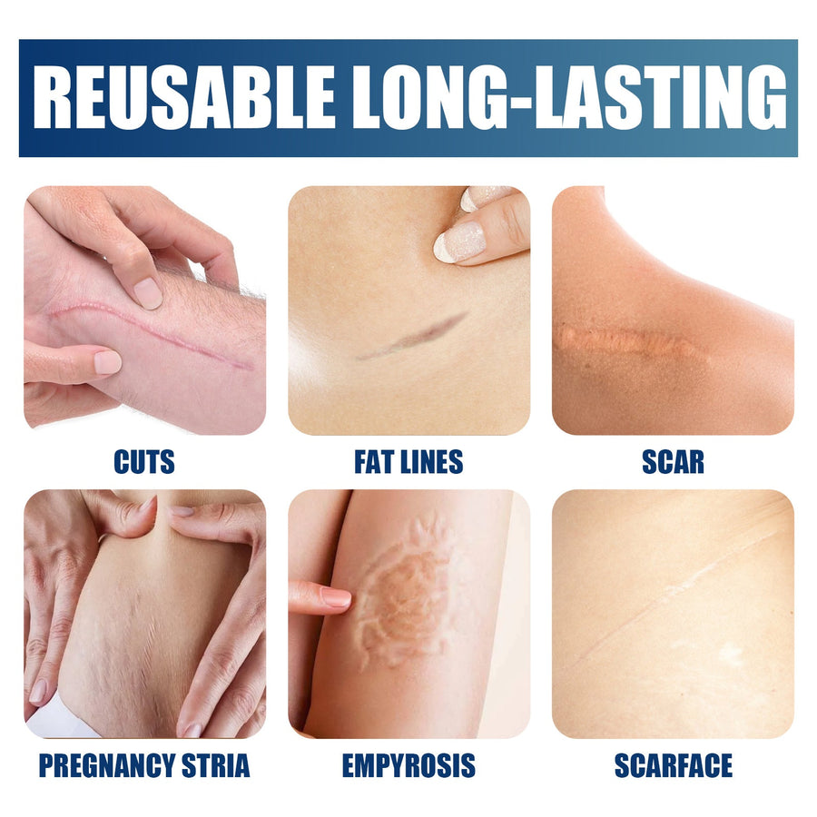 Scar Repair Gel for Smoother, Flatter-Looking Scars