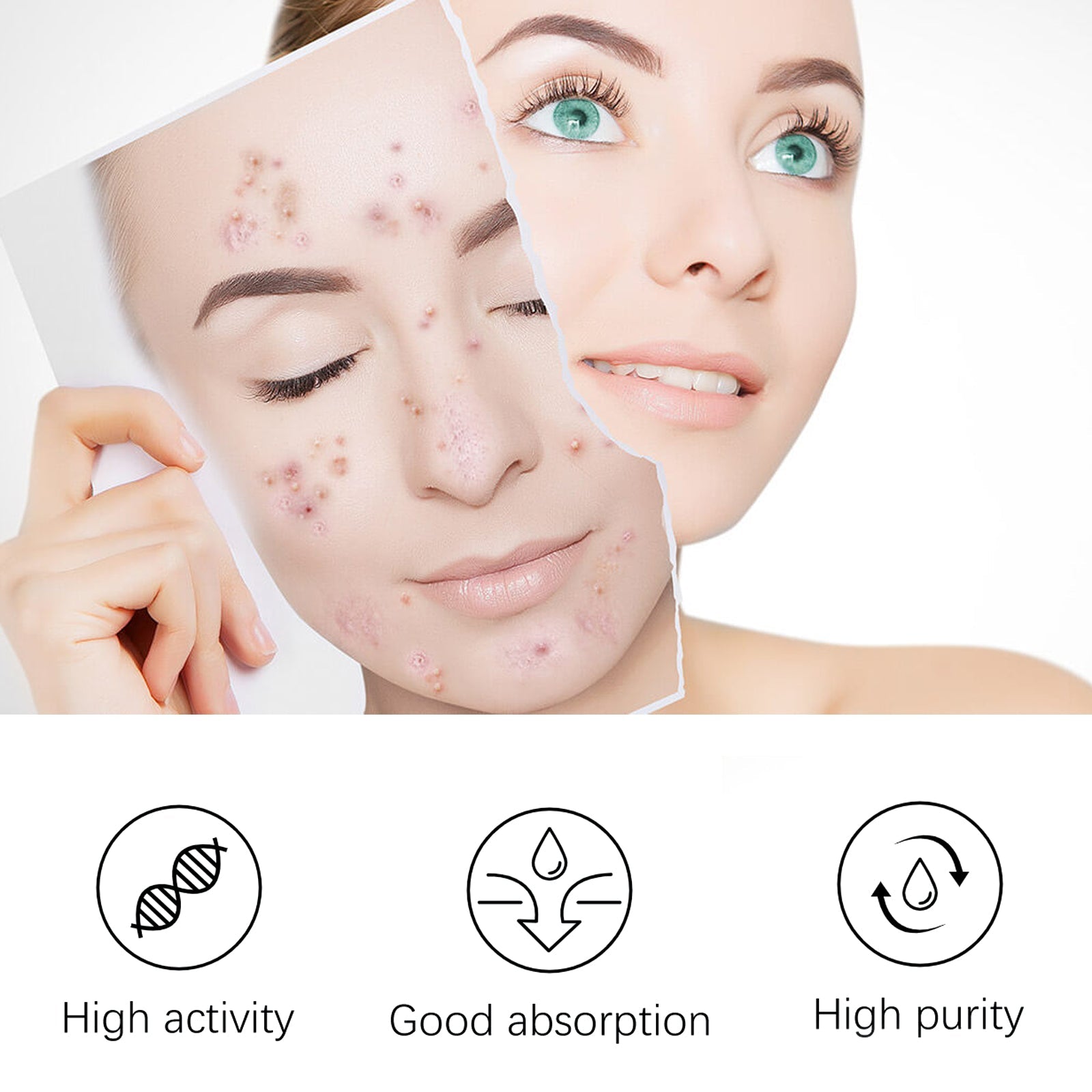 Clear-skin woman with 'DEEP RELIEF ACNE TREATMENT' headline text in blue italics; three numbered mechanism boxes below