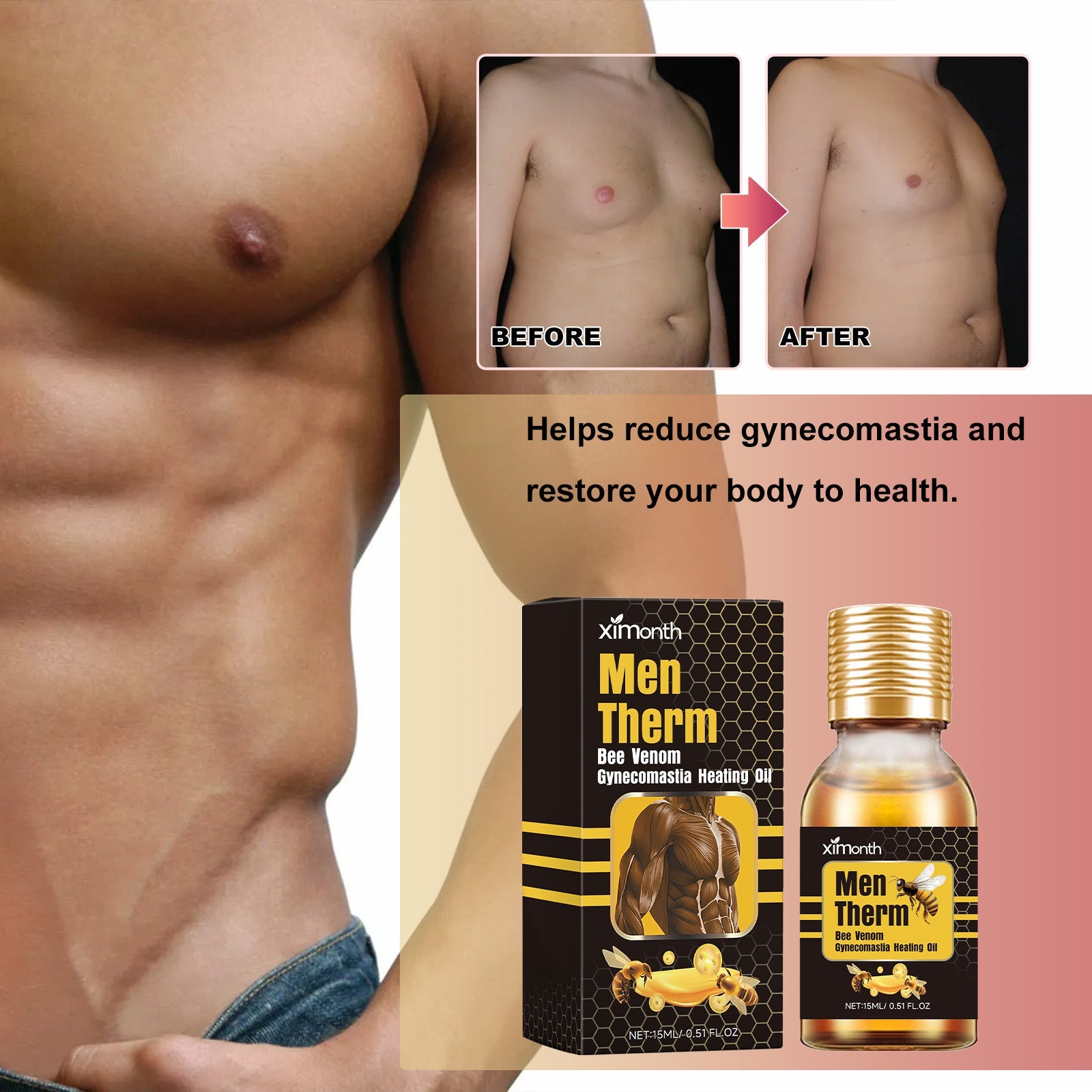 Before and after comparison showing chest area with visible reduction in gynecosmastia with text overlay
