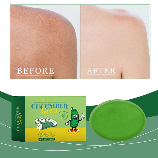 Cucumber Cleansing Soap for Oily Skin Control