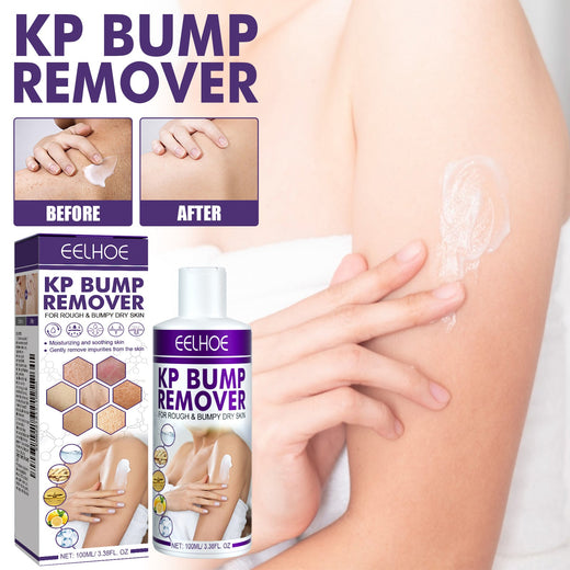 KP Bump Remover Cream for Smoother, Softer Skin
