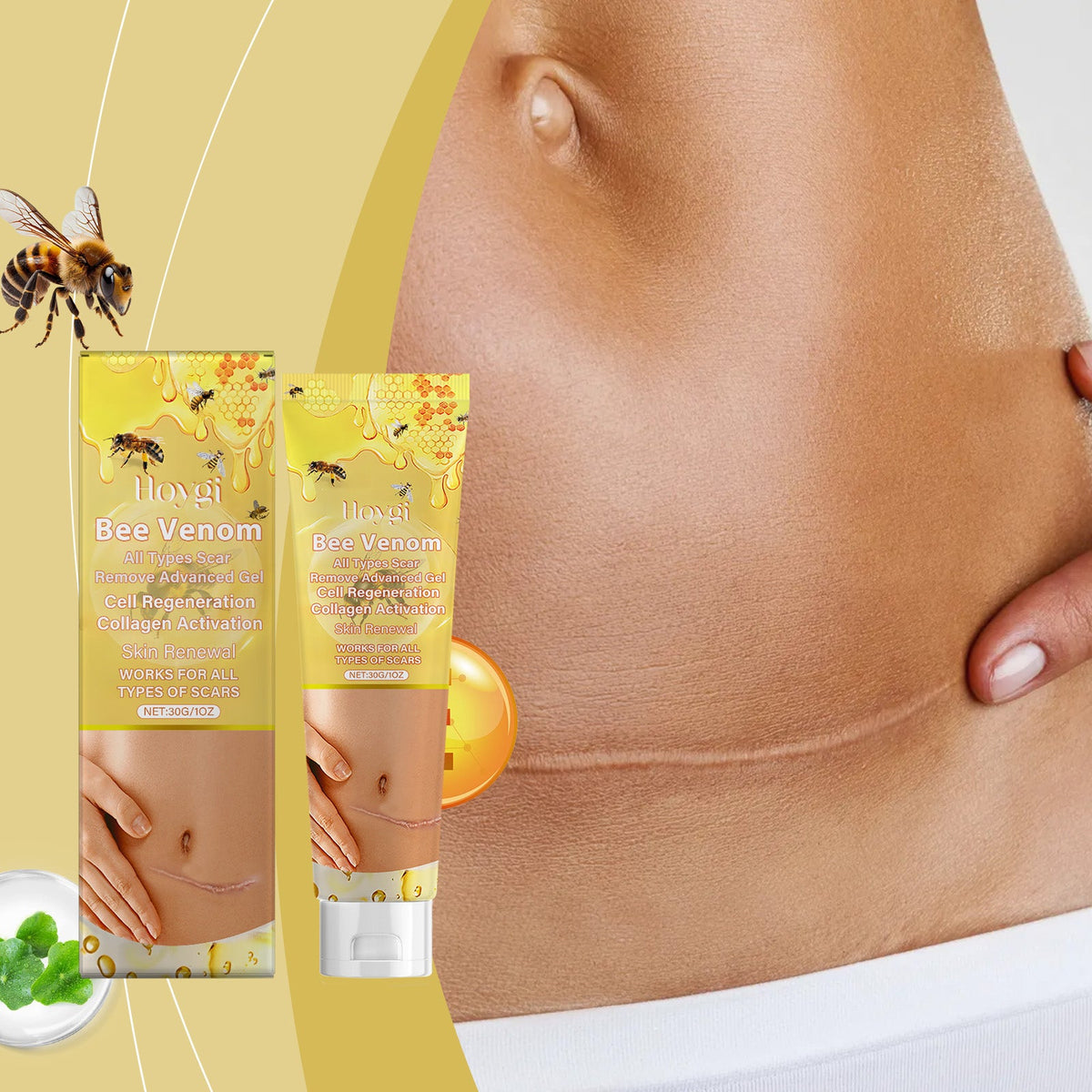 Bee Venom Scar Gel - Daily Repair for Smoother Skin