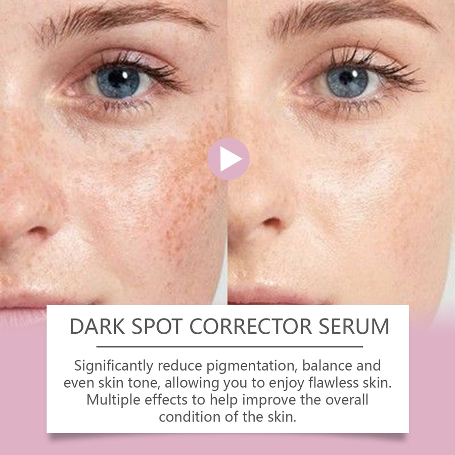 Dark Spot Corrector Serum for Brighter, Even Skin Tone