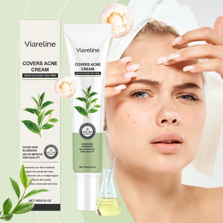 Salicylic Acid Acne Cream for Clearer, Balanced Skin