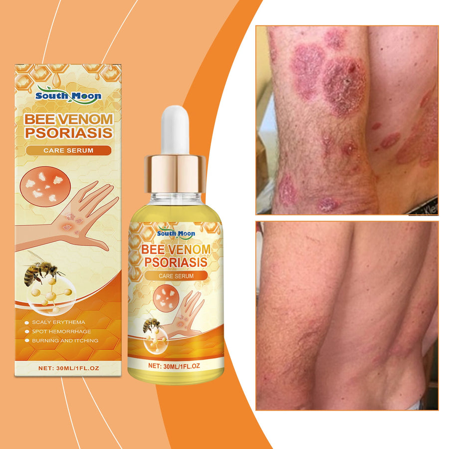 Bee Venom Body Essence for Dry, Irritated Sensitive Skin