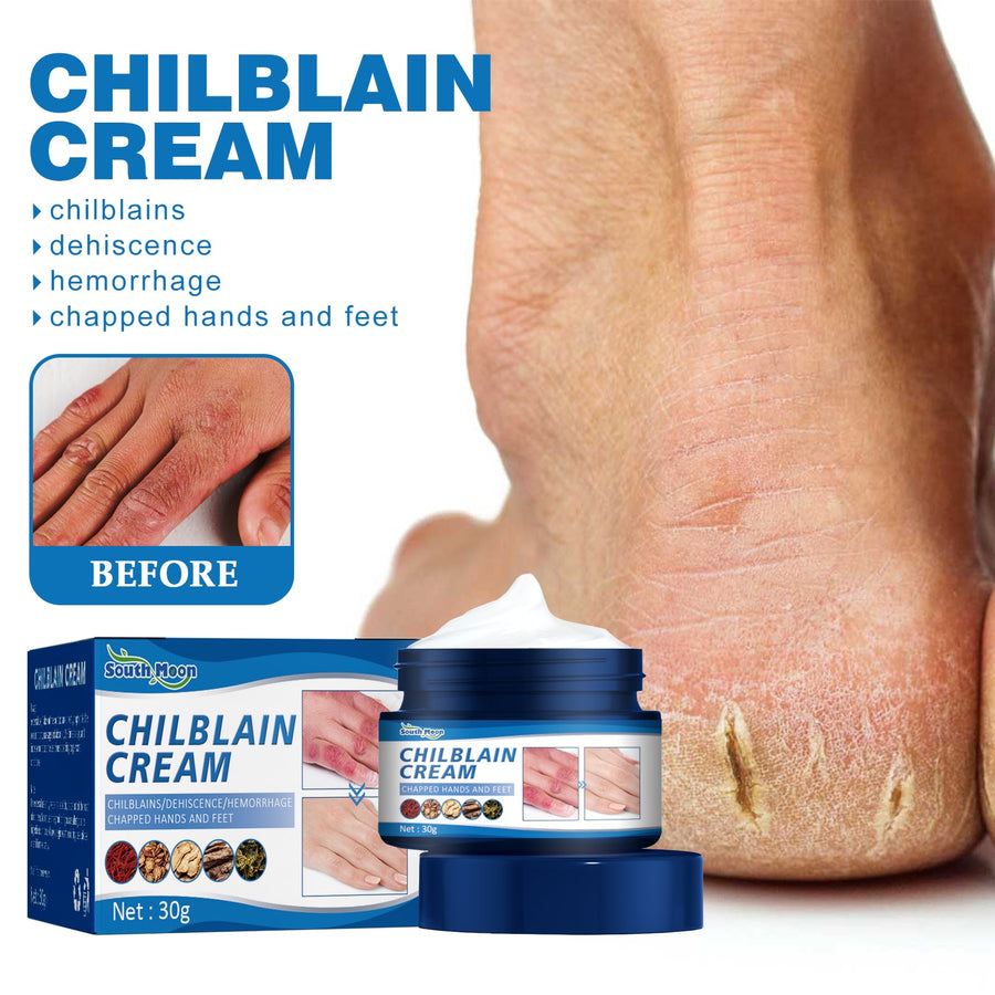 Chilblain Relief Cream – Heals Severe Cracking & Peeling Fast
