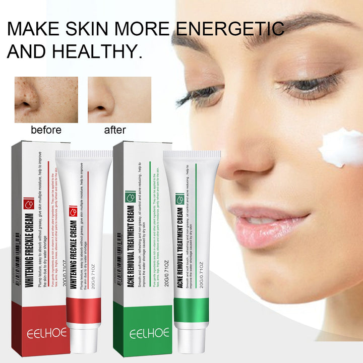 Dual-Formula Acne Cream Set — Clear Skin & Fade Dark Spots