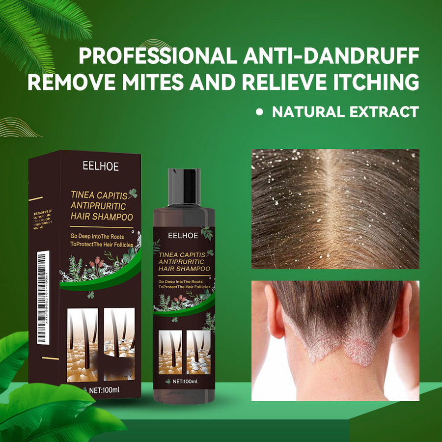 Anti-Dandruff Shampoo for Itchy, Oily Scalp Care