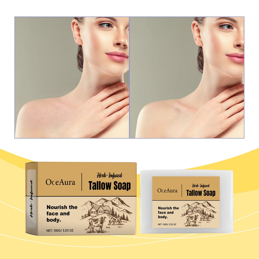 Tallow Soap Bar for Dry, Sensitive Skin – Herb Infused