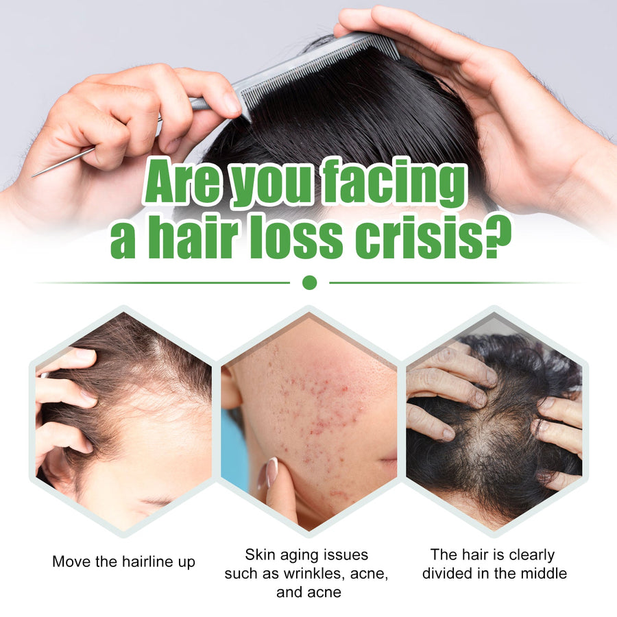 Castor Oil Hair Care for Fuller-Looking, Healthier Hair