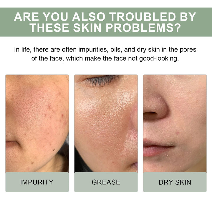 Houttuynia Pore Cleansing Foam for Oily Acne-Prone Skin