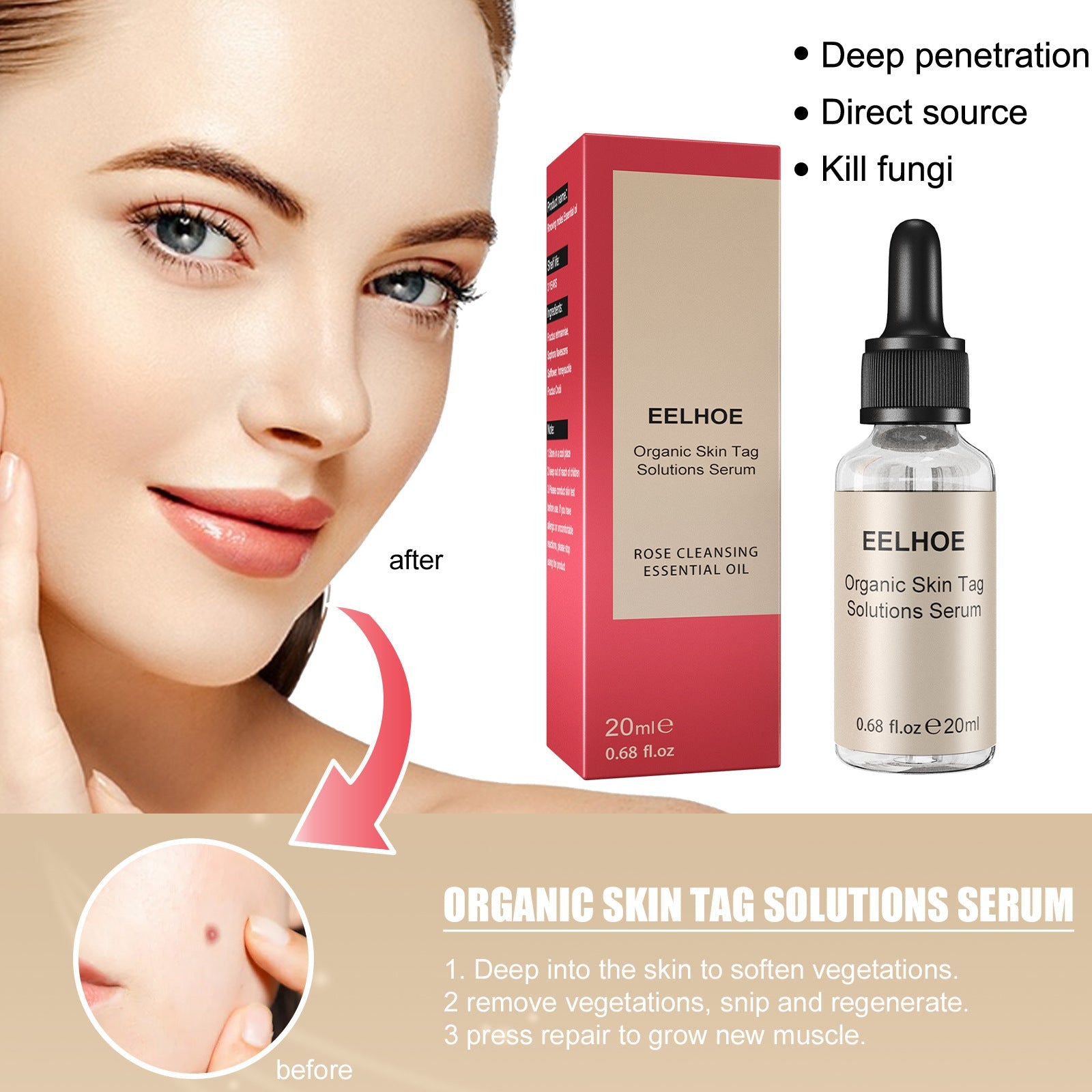 Before and after facial results with key benefit claims: Deep penetration, Direct source, Kill fungi