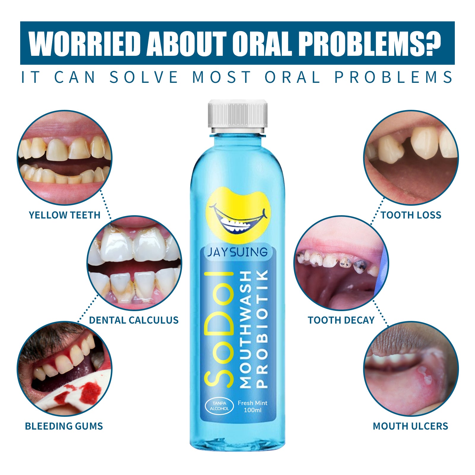 Two smiling young women with the mouthwash bottle on left, before/after close-up mouth shots showing yellow to white teeth transformation