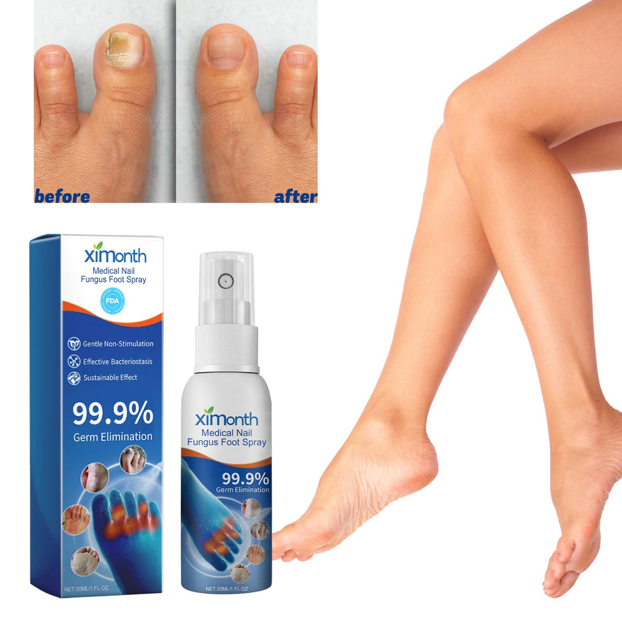 Nail Fungus Spray - Repair Thick Gray Damaged Toenails Fast