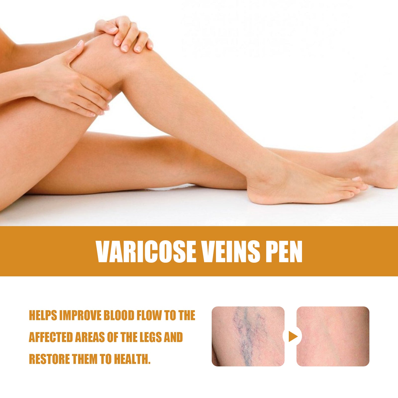 Close-up of female leg showing visible purple varicose veins, demonstrating the problem the product targets